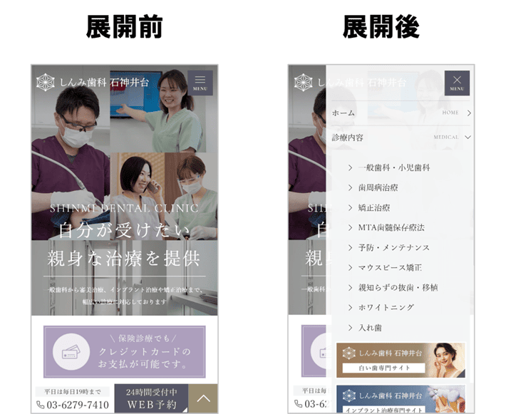 しんみ歯科石神井台のハンバーガーメニュー